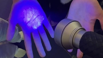 Billede af hænder under en UV-lampe